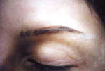 Female Eyebrow example 2 before